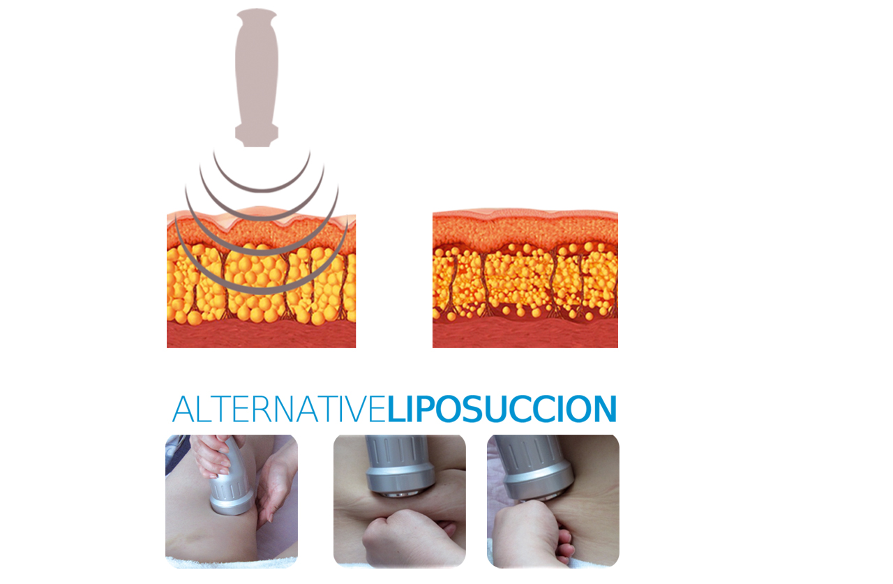 Machine-Amincissement-Par-Lipocavitation