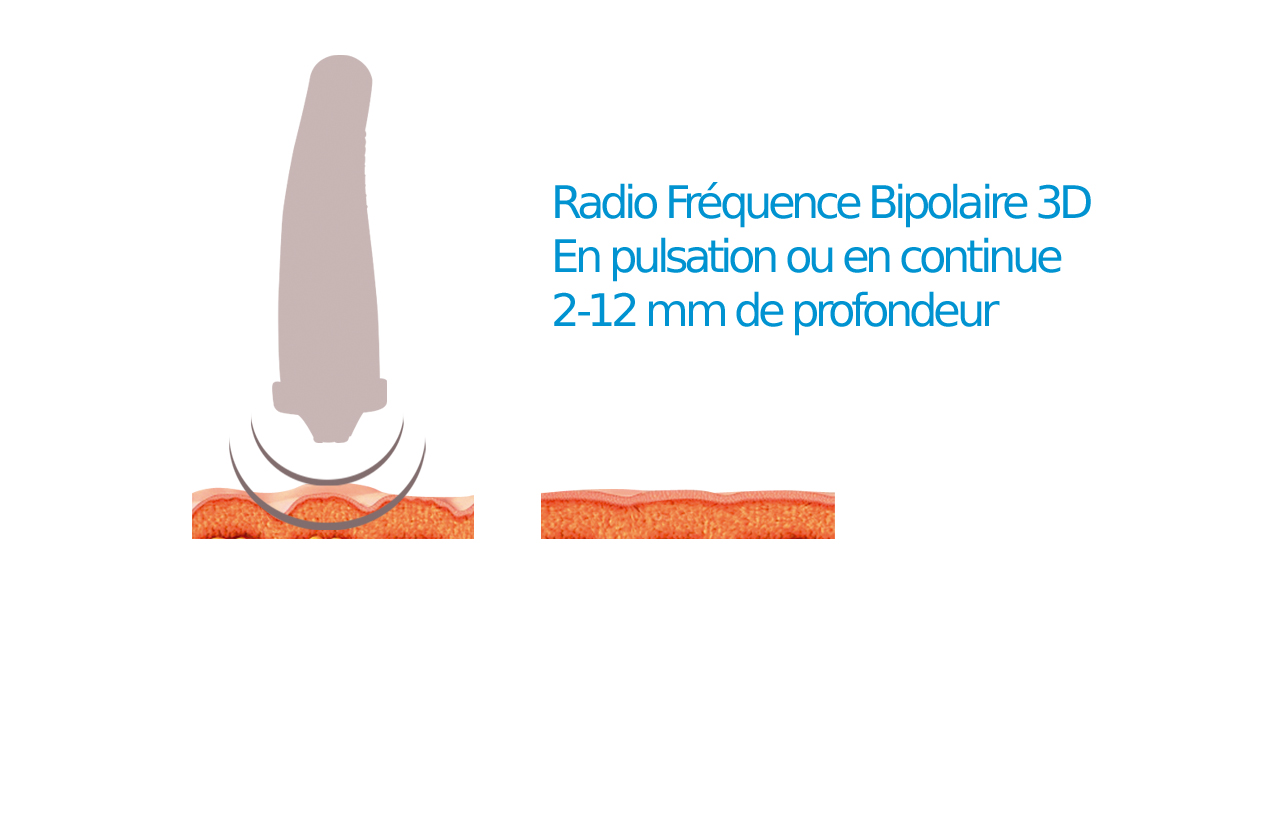 Materiel-Esthetique-Radiofrequence-Bipolaire-3D