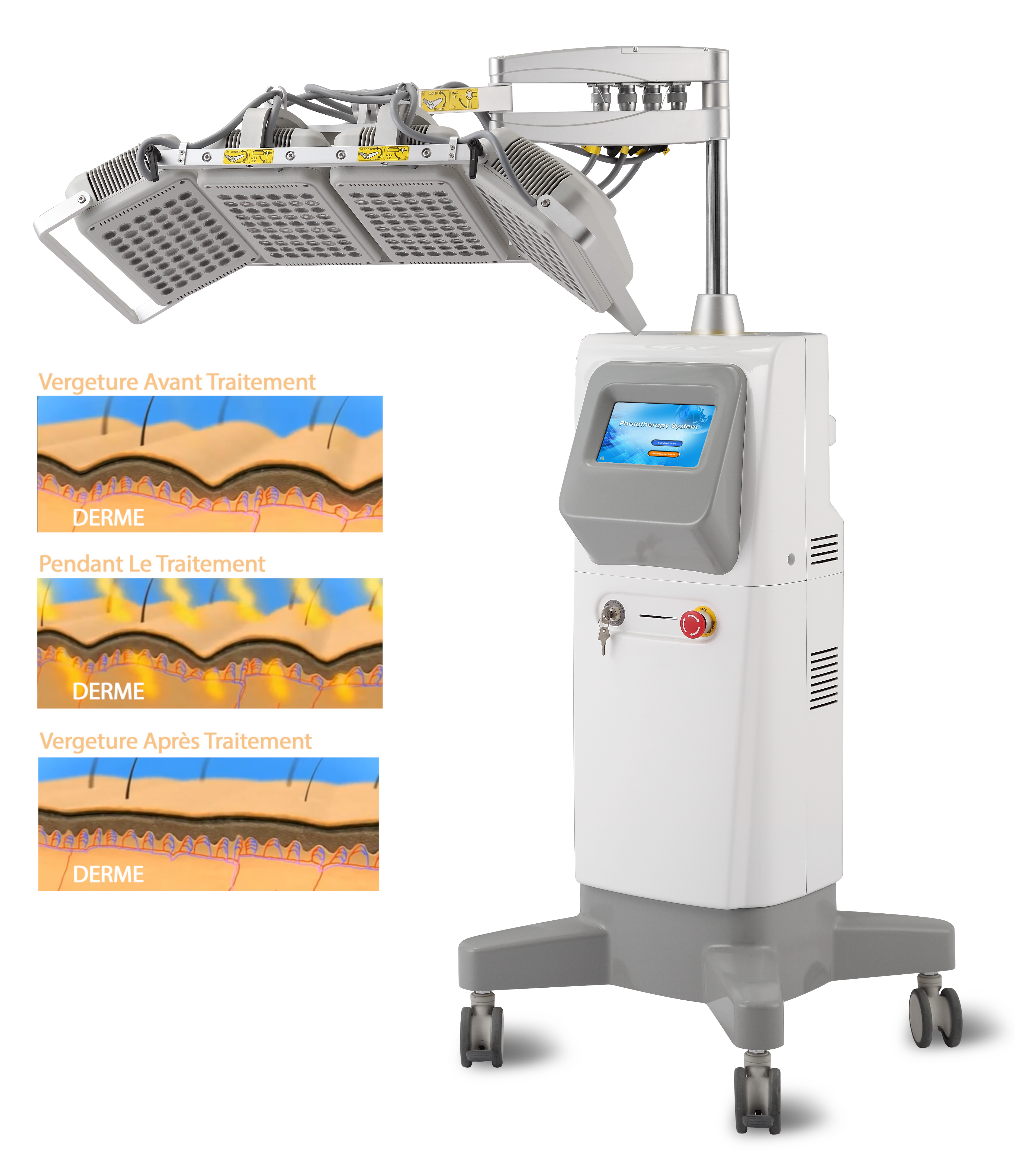 Machine-Amincissement-Par-Lipocavitation